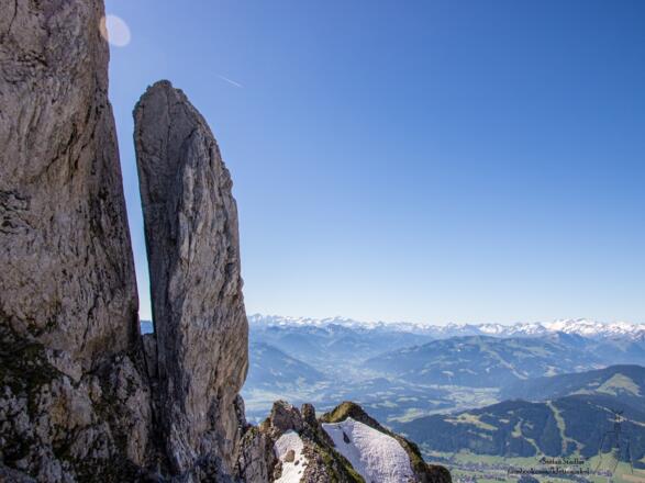 die Kaindl-Stewart-Nadel kurz vor dem Kopftörl